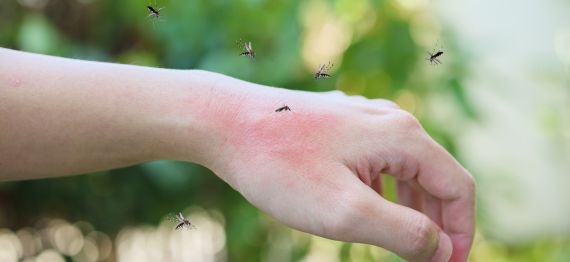 Alergia la intepaturi de insecte: cum sa va protejati de reactiile alergice
